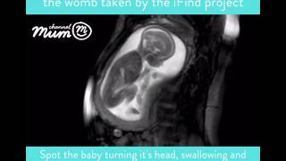 MRI Scan Video of Baby Moving in Womb  Channel Mum [upl. by Ruthven]