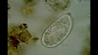 Paramecium putrinum Paramecium trichium [upl. by Suravat]