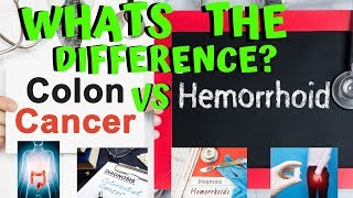 What Are the Differences Between Colon Cancer and Hemorrhoid Symptoms and Signs [upl. by Adlin46]