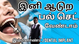 Fixed பல் கட்டும் முறைஇம்ப்ளாண்ட் சிகிச்சை𝐃𝐞𝐧𝐭𝐚𝐥 𝐈𝐦𝐩𝐥𝐚𝐧𝐭 𝐓𝐫𝐞𝐚𝐭𝐦𝐞𝐧𝐭 𝐢𝐧 𝐓𝐚𝐦𝐢𝐥𝐏𝐚𝐥 𝐤𝐚𝐭𝐭𝐮𝐯𝐚𝐭𝐡𝐮 𝐞𝐩𝐩𝐚𝐝𝐢 [upl. by Enwad]