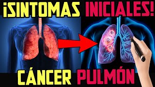 PELIGRO 8 SINTOMAS DEL CÁNCER DE PULMÓN [upl. by Ggerk]