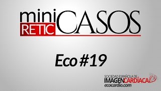 miniCASOS  Eco 19  Pregunta [upl. by Kamin167]