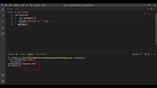 IndentationError unexpected indent Problem Solve Python VSCODE [upl. by Adnolat]