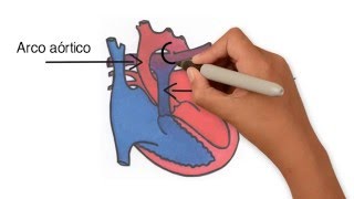 Persistencia del conducto arterioso [upl. by Okechuku304]