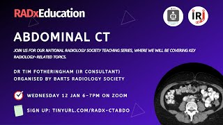 Abdominal CTsIntervention  RadX Teaching Series [upl. by Glendon]