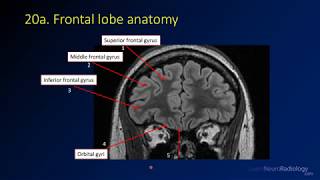 Neuroradiology review  brain gyral anatomy [upl. by Gage]