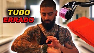 MINOXIDIL  DERMAROLLER x TOALHA QUENTE Quando Usar  BARBA PRETA [upl. by Anerol]