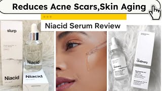 Niacinamide Serum  Niacid Serum  The Ordinary Niacinamide serum Review  Acne Scars serum  Niacid [upl. by Undis]