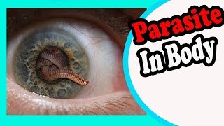 10 Signs And Symptoms Your Body is Full of Parasites [upl. by Nosirb]