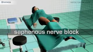 Saphenous nerve block [upl. by Margetts755]