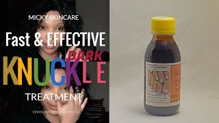 Fade Off Dark Knuckles Fast amp Effective  Fongicide Natural Light  Dark Knuckles Treatment [upl. by Uah]