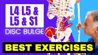 L4 L5 amp L5 S1 Disc Bulge Best Exercises Rehab For Relief [upl. by Millie932]