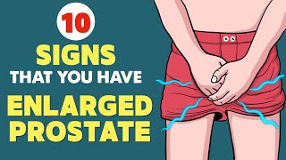 Enlarged Prostate BPH  Signs amp Symptoms  Every Man Needs to Know This [upl. by Orlando389]