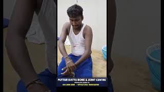 elbow dislocation treatment  முழங்கை மூட்டு விலகல்  vadapalani  puttur kattu [upl. by Alyssa]