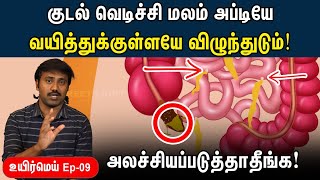 யாருக்கெல்லாம் appendix பிரச்சனை வரும்  Appendicitis explained in Tamil  Uyirmei EP  09 [upl. by Lingwood]