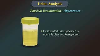 Urine Analysis [upl. by Tevis]