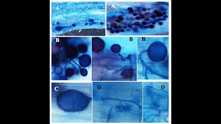 CLEARING AND STAINING OF MYCORRHIZAL ROOTS  PRACTICAL [upl. by Debor]