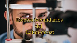 Efectos Secundarios del Latanoprost [upl. by Schilt]