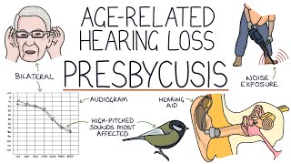 Understanding Presbycusis AgeRelated Hearing Loss [upl. by Alekin]