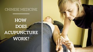 Chinese Medicine Basics  How does Acupuncture work [upl. by Aenyl]