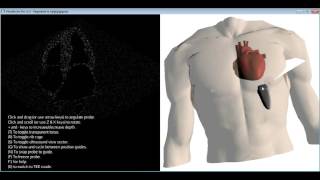 How to get the standard transthoracic echocardiography TTE views [upl. by Selegna947]