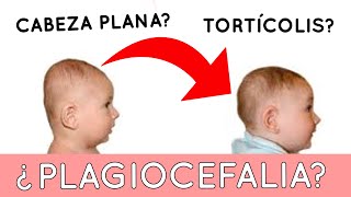 Problemas de cabeza plana en bebés 👶 LA PLAGIOCEFALIA 👈 [upl. by Merril14]