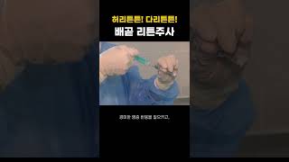 배곧정형외과 프롤로 주사치료  허리 튼튼 다리 튼튼 다시 튼튼해지는 리튼주사 프롤로주사 리튼주사 평9토5 [upl. by Hpseoj22]