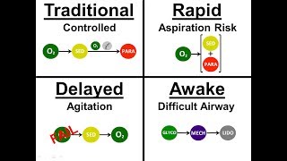 Introduction to Intubation  01  Approach Sequence [upl. by Akeemahs]