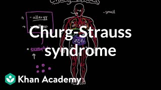 ChurgStrauss syndrome  Circulatory System and Disease  NCLEXRN  Khan Academy [upl. by Attenrev579]