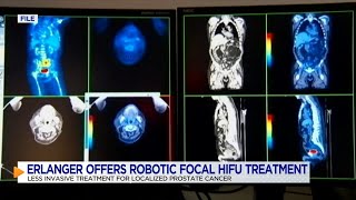 Erlanger offers advanced robotic HIFU treatment for prostate cancer [upl. by Justicz427]