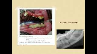 NonInvasive Mandibular Fracture Repair [upl. by Jamnis]