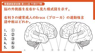 【コクシ解説】【111AM077】脳の外側面を左右から見た模式図を示す【看護師国家試験第111回午前077問】 [upl. by Torosian130]