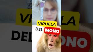 ¿EXISTE algún Tratamiento Eficaz para la VIRUELA del MONO 🙊 💉 virueladelmono mpox [upl. by Moretta]