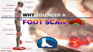 Correcting pronation leads to whole body health benefits Why you need a foot scan [upl. by Nawotna230]