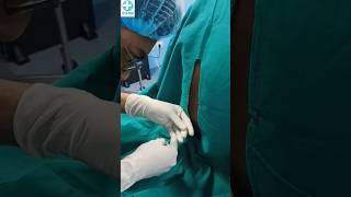 spinal anaesthesia doctor patient hospital injection [upl. by Egnalos]