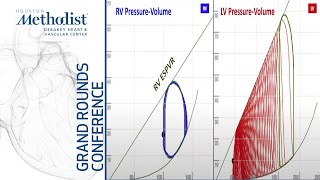 Cardiogenic Shock How Physiology has Changed Clinical Practice Daniel Burkhoff MD April 15 2021 [upl. by Ahsiak]