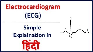 Understand Electrocardiogram ECG in Hindi  Bhushan Science [upl. by Ahsinotna11]