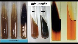 Bile Esculin Test A Biochemical Test for selective Differentiation in Enterococcus amp Streptococcus [upl. by Alis719]