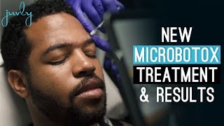 Micro Botox Technique with Dr Justin Harper and his Expert Team [upl. by Euqirat]