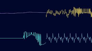 reissecup  freeker chiptune cover of keller williams  freeker by the speaker [upl. by Meter]