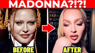 Plastic Surgeon MADONNAs Cosmetic Surgery Transformation [upl. by Odlabso833]