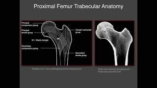 Imaging of hip [upl. by Hephzibah72]