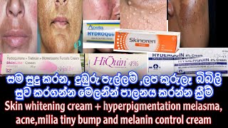 Skin whitening ඕනඅයට creamඑකක් සහ hyperpigmentation melasma‘acnemiliaතියනඅයටත් medicated cream [upl. by Nael767]