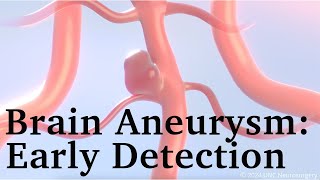 Brain Aneurysms Early Detection [upl. by Bagger430]