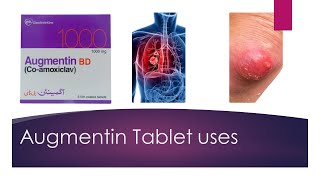 Augmentin tablet uses  augmentin tablet side effects  chest infection  pneumonia treatment [upl. by Ainna]