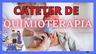 CATÉTER DE QUIMIOTERAPIA [upl. by Alohs]