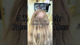 Stop Hair Loss NOW With These Simple Tips [upl. by Ayidan]