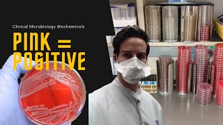 Microbiology Indole Test for E coli [upl. by Hannan]