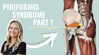 Piriformis Syndrome Part 1 [upl. by Ecidnac]