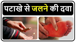 स्किन जलने की दवाइया त्वचा जल जाए तो Skin Burn treatment [upl. by Angrist735]